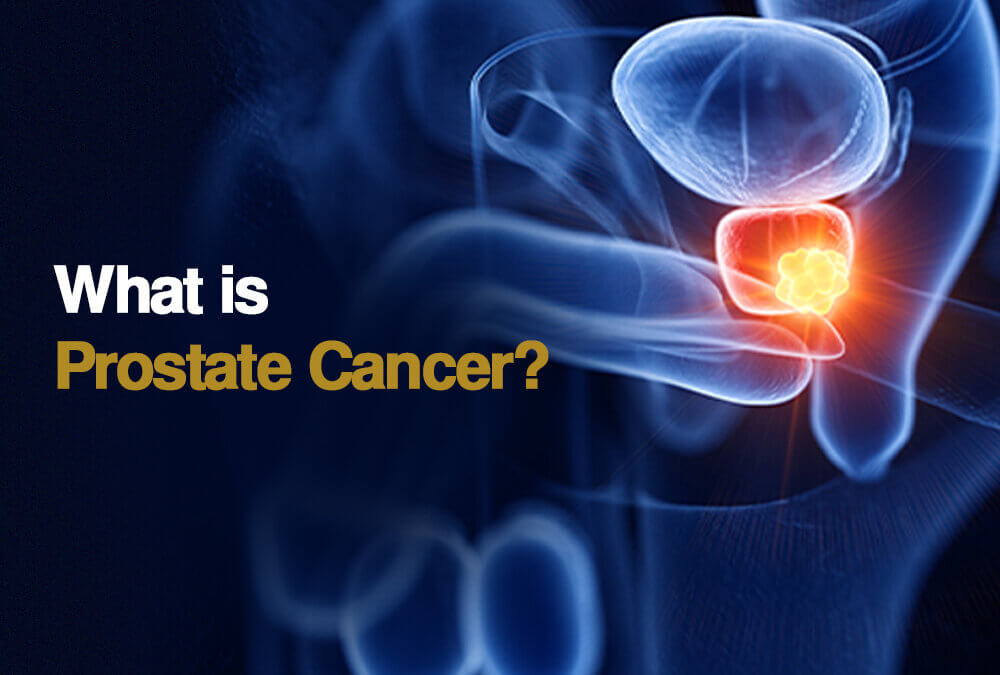 What is Prostate Cancer?