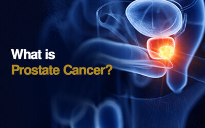 What is Prostate Cancer?