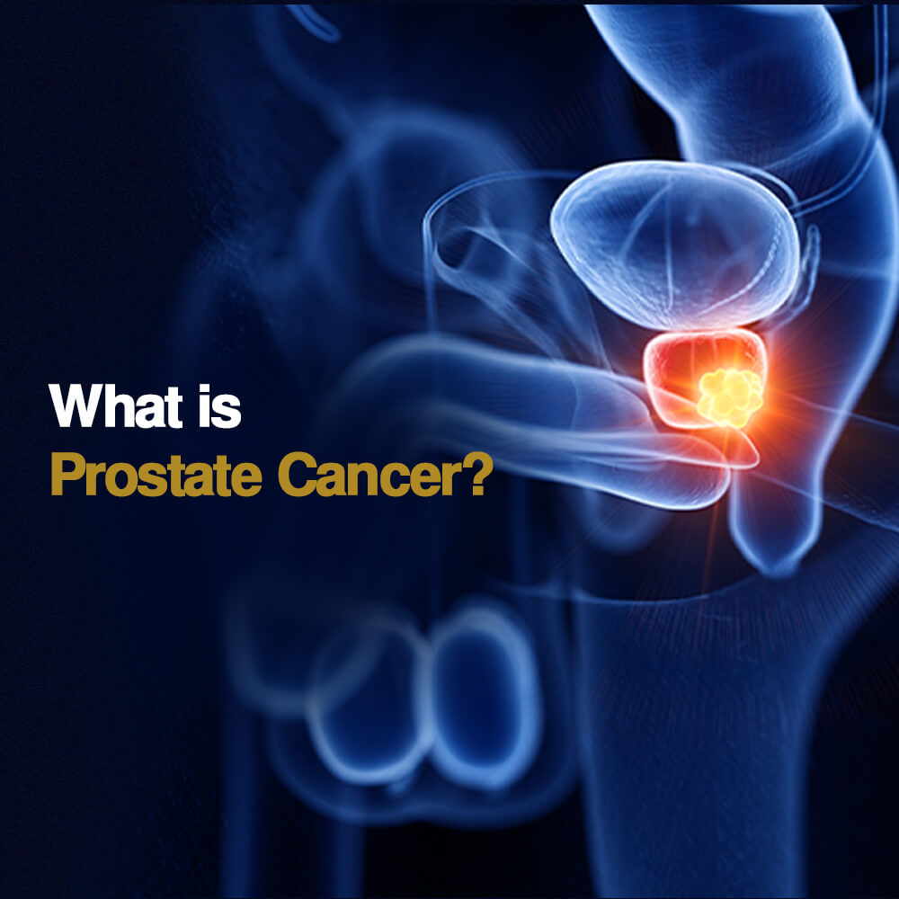 prostate 