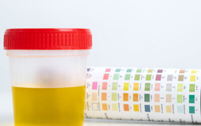 Components of a Urinalysis and What They Indicate
