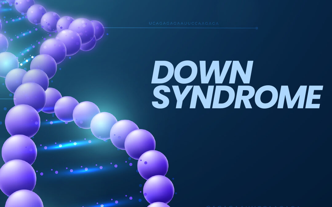 Down Syndrome Explained