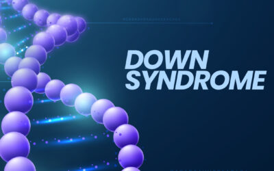 Down Syndrome Explained